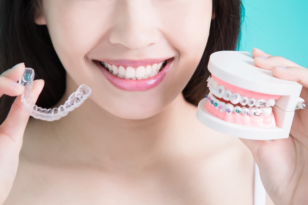 Traditional VS Invisalign Braces Brite Smiles Dentistry dentist in Flower Mound, Tx Dr. Deepika Salguti DMD