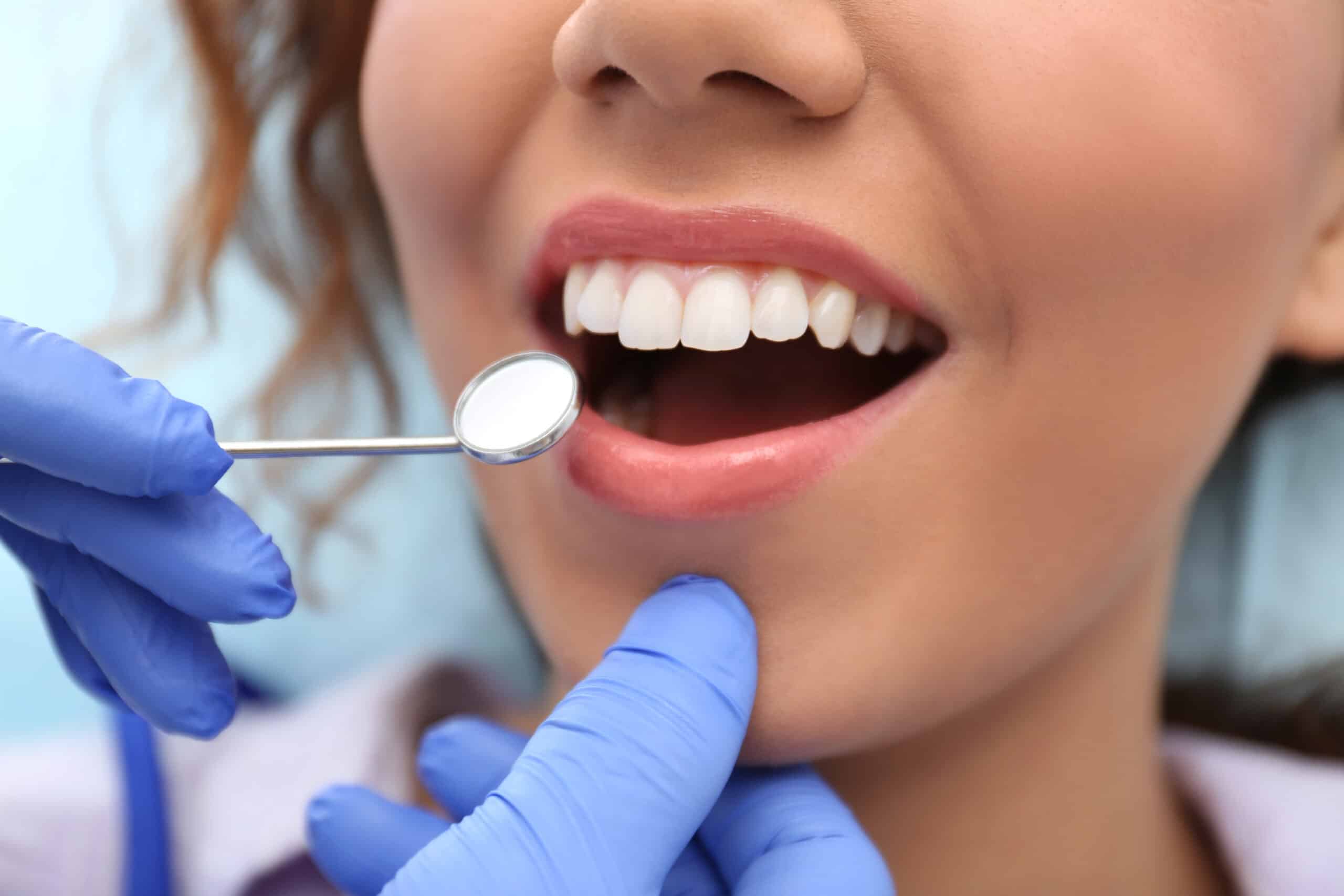 teeth whitening near me Brite Smiles Dentistry dentist in Flower Mound, TX Dr. Deepika Salguti, D.M.D.
